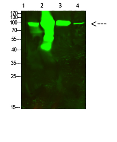 ACO2兔多抗,ACO2 Rabbit Polyclonal Antibody