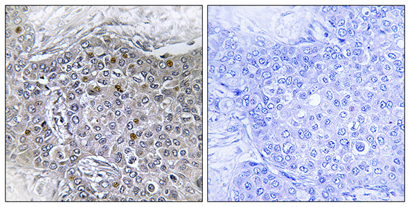 BS69兔多抗,BS69 Rabbit Polyclonal Antibody