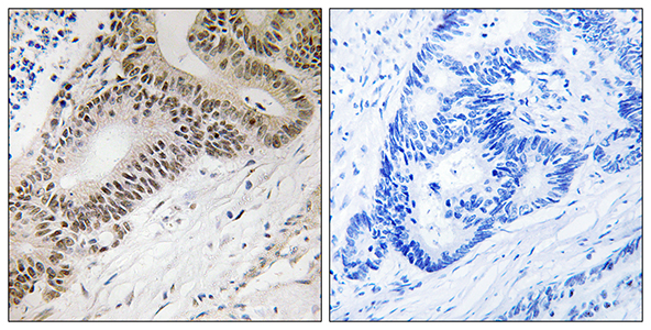 FoxO3A兔多抗,FoxO3A Rabbit Polyclonal Antibody