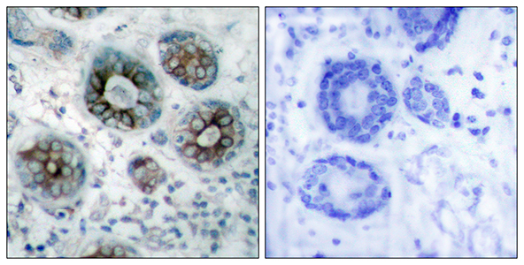 GAP-43兔多抗,GAP-43 Rabbit Polyclonal Antibody