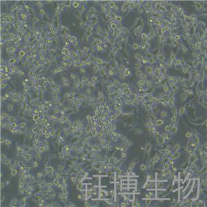 STC-1（小鼠小肠内分泌细胞系）YB-7042MC,STC-1