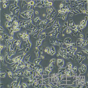 HepAD38（人肝癌细胞）YB-71853HC