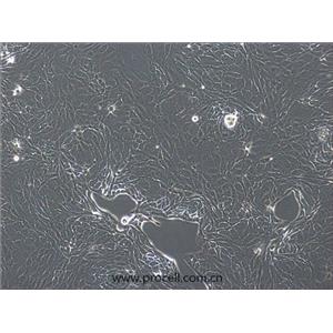 NCI-H2444细胞 (人非小细胞肺癌细胞) (STR鉴定正确)CL-0898