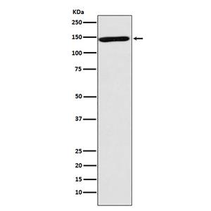NRCAM (13T10)兔单抗,NRCAM (13T10) Rabbit Monoclonal Antibody
