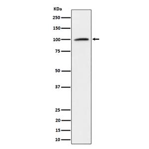 Nucleolin (7Z11)兔单抗,Nucleolin (7Z11) Rabbit Monoclonal Antibody