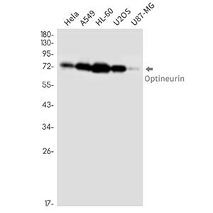 Optineurin (3D13)兔单抗,Optineurin (3D13) Rabbit Monoclonal Antibody