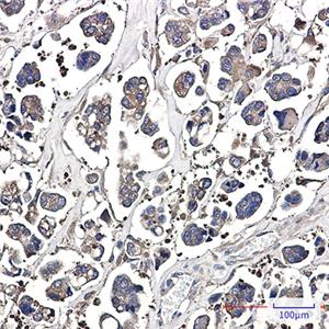 Optineurin (3D13)兔单抗,Optineurin (3D13) Rabbit Monoclonal Antibody