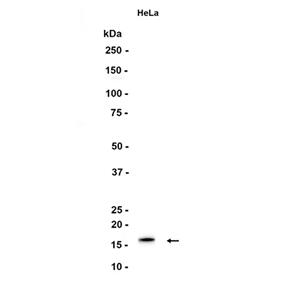 p16 INK (16J3)兔单抗,p16 INK (16J3) Rabbit Monoclonal Antibody
