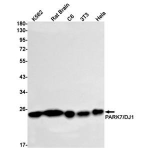 PARK7 (9L2)兔单抗,PARK7 (9L2) Rabbit Monoclonal Antibody