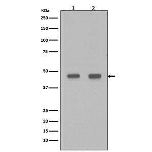 PDX1 (9B19)兔单抗,PDX1 (9B19) Rabbit Monoclonal Antibody