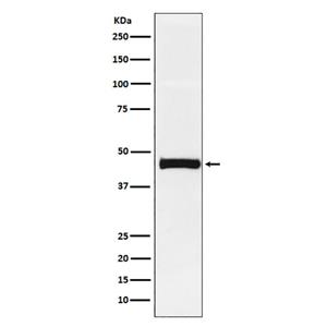 Pentraxin 3 (14E14)兔单抗,Pentraxin 3 (14E14) Rabbit Monoclonal Antibody