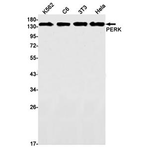 PERK (16C18)兔单抗,PERK (16C18) Rabbit Monoclonal Antibody