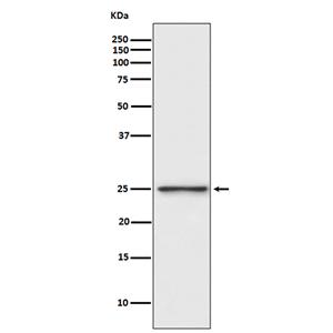 PGP9.5 (5O2)兔单抗,PGP9.5 (5O2) Rabbit Monoclonal Antibody