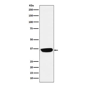 PHOX2B (7H13)兔单抗,PHOX2B (7H13) Rabbit Monoclonal Antibody