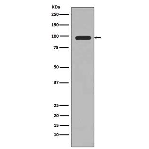 PI 3 Kinase Class 3 (11Y1)兔单抗,PI 3 Kinase Class 3 (11Y1) Rabbit Monoclonal Antibody