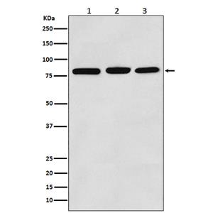 PI3 Kinase p85 alpha (4H15)兔单抗,PI3 Kinase p85 alpha (4H15) Rabbit Monoclonal Antibody