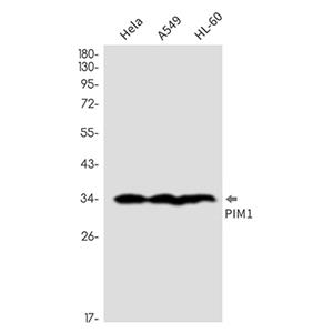 PIM1  (3I7)兔单抗,PIM1  (3I7) Rabbit Monoclonal Antibody