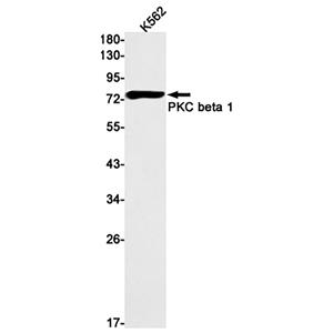 PKC beta 2  (12R10)兔单抗,PKC beta 2  (12R10) Rabbit Monoclonal Antibody