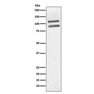 PML (11A3)兔单抗,PML (11A3) Rabbit Monoclonal Antibody