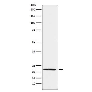 PMP22 (2M9)兔单抗,PMP22 (2M9) Rabbit Monoclonal Antibody