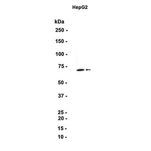 PMP70 (6N3)兔单抗,PMP70 (6N3) Rabbit Monoclonal Antibody
