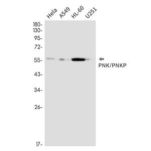 PNK / PNKP (12Y10)兔单抗,PNK / PNKP (12Y10) Rabbit Monoclonal Antibody