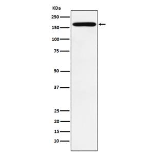 PODXL (13I5)兔单抗,PODXL (13I5) Rabbit Monoclonal Antibody