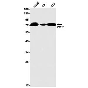 POT1 (19U2)兔单抗,POT1 (19U2) Rabbit Monoclonal Antibody