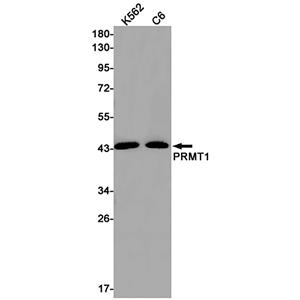 PRMT1 (2C19)兔单抗,PRMT1 (2C19) Rabbit Monoclonal Antibody
