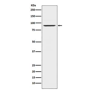 Prolactin Receptor (2K9)兔单抗,Prolactin Receptor (2K9) Rabbit Monoclonal Antibody