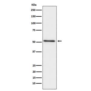 Prostatic Acid Phosphatase (14A5)兔单抗,Prostatic Acid Phosphatase (14A5) Rabbit Monoclonal Antibody