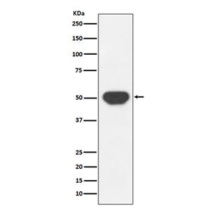 PTP1B (13P19)兔单抗,PTP1B (13P19) Rabbit Monoclonal Antibody