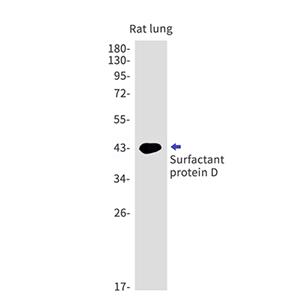 Pulmonary Surfactant Associated Protein D (13G17)兔单抗,Pulmonary Surfactant Associated Protein D (13G17) Rabbit Monoclonal Antibody