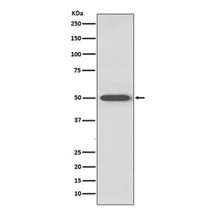 RAGE (1P3)兔单抗,RAGE (1P3) Rabbit Monoclonal Antibody