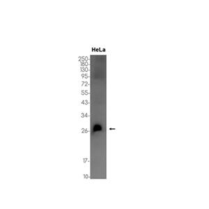 RCHY1 (11B14)兔单抗,RCHY1 (11B14) Rabbit Monoclonal Antibody