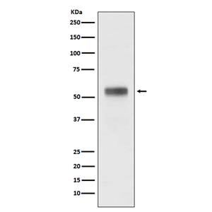 Retinoic Acid Receptor alpha (12V14)兔单抗,Retinoic Acid Receptor alpha (12V14) Rabbit Monoclonal Antibody