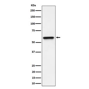 RGS6 (3A18)兔单抗,RGS6 (3A18) Rabbit Monoclonal Antibody