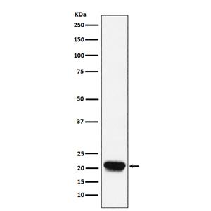 RHEB (18Y18)兔单抗,RHEB (18Y18) Rabbit Monoclonal Antibody