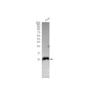 S100 alpha 6 (12M1)兔单抗,S100 alpha 6 (12M1) Rabbit Monoclonal Antibody