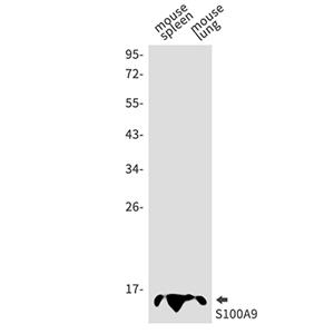 S100 alpha9 (13Z5)兔单抗,S100 alpha9 (13Z5) Rabbit Monoclonal Antibody