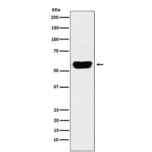 Salivary alpha amylase (5D14)兔单抗,Salivary alpha amylase (5D14) Rabbit Monoclonal Antibody