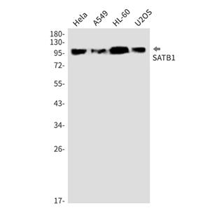 SATB1 (11U13)兔单抗,SATB1 (11U13) Rabbit Monoclonal Antibody