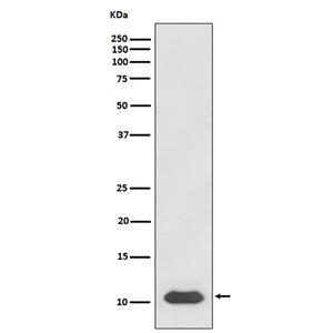 SDF1 (12B8)兔单抗,SDF1 (12B8) Rabbit Monoclonal Antibody