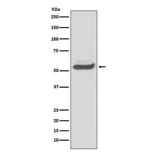 SERPINA1 (2F7)兔单抗,SERPINA1 (2F7) Rabbit Monoclonal Antibody