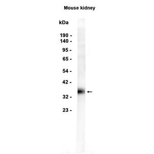 SFRP1 (1U15)兔单抗,SFRP1 (1U15) Rabbit Monoclonal Antibody