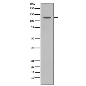 SHIP (11I8) Rabbit Monoclonal Antibody | 兔单抗 | EnkiLife恩玑生命