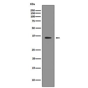 SIRT2  (7W12)兔单抗,SIRT2  (7W12) Rabbit Monoclonal Antibody