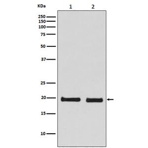 Skp1 (15O8)兔单抗,Skp1 (15O8) Rabbit Monoclonal Antibody