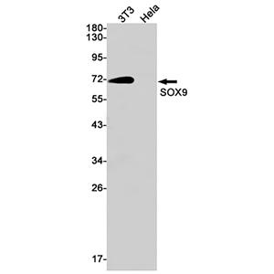 SOX9 (17B14)兔单抗,SOX9 (17B14) Rabbit Monoclonal Antibody