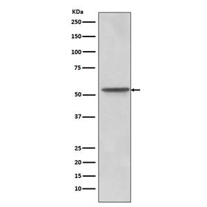 Src  (12F19)兔单抗,Src  (12F19) Rabbit Monoclonal Antibody